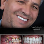 نمونه کار ایمپلت اصفهان